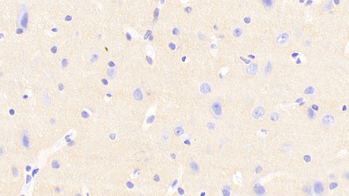 Polyclonal Antibody to Neurocan (NCAN)