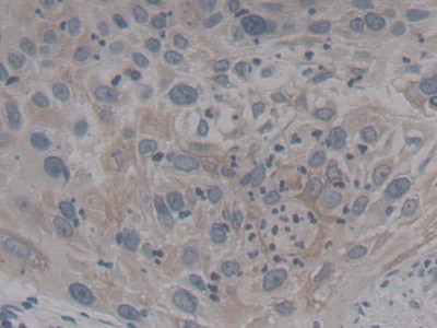 Polyclonal Antibody to Neurotrophic Tyrosine Kinase Receptor Type 3 (NTRK3)