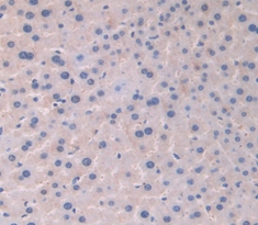 Polyclonal Antibody to Axis Inhibition Protein (AXIN)