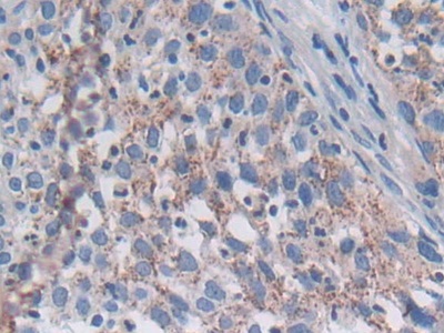 Polyclonal Antibody to Sorting Nexin 13 (SNX13)