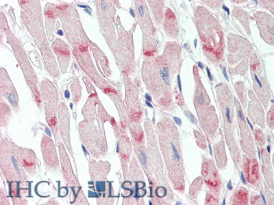 Polyclonal Antibody to Desmoglein 2 (DSG2)