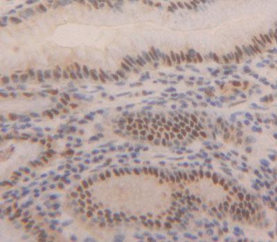 Polyclonal Antibody to Methyl CpG Binding Domain Protein 2 (MBD2)