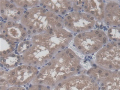 Polyclonal Antibody to Host Cell Factor C1 (HCFC1)