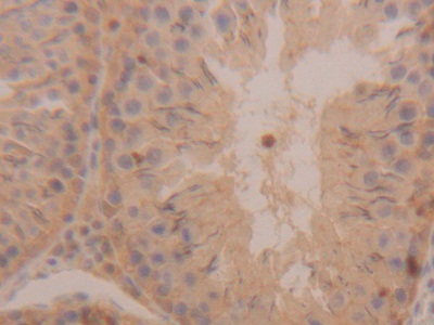 Polyclonal Antibody to Bleomycin Hydrolase (BLMH)