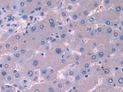 Polyclonal Antibody to Cortactin (CTTN)