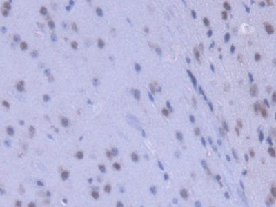Polyclonal Antibody to Heterogeneous Nuclear Ribonucleoprotein A1 (HNRNPA1)