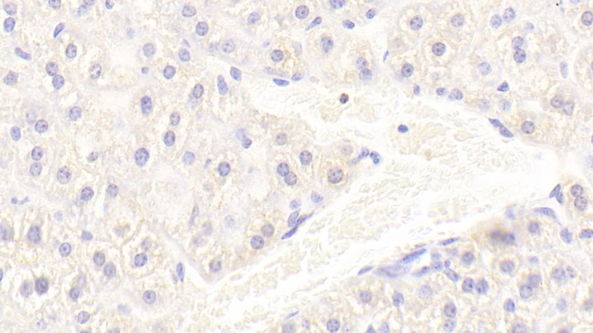 Polyclonal Antibody to Allograft inflammatory factor 1 (AIF1)