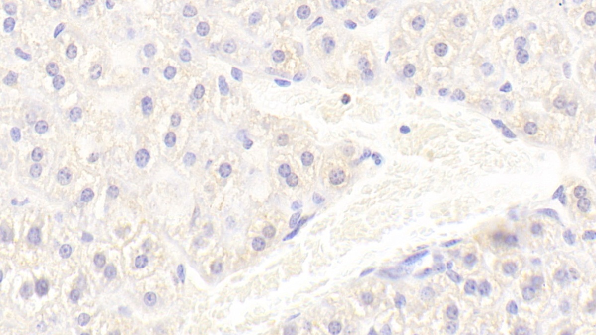 Polyclonal Antibody to Ionized Calcium-binding Adapter Molecule 1 (IBA1)