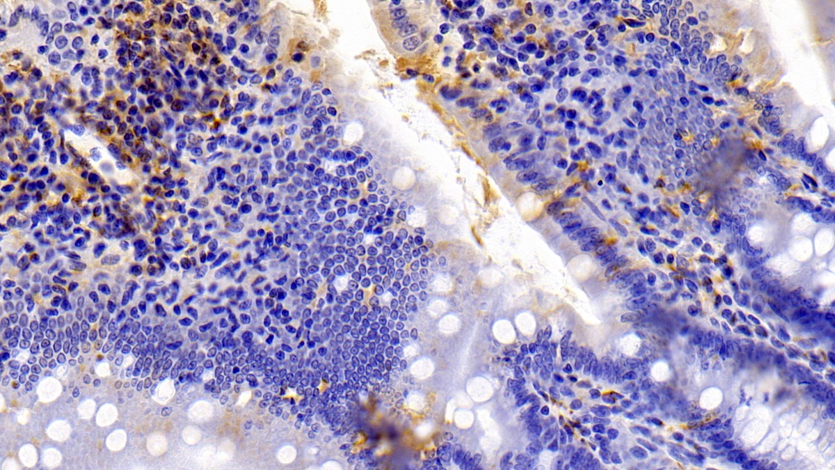 Polyclonal Antibody to Allograft inflammatory factor 1 (AIF1)
