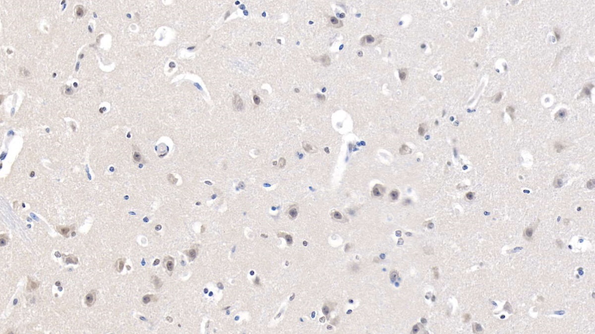 Polyclonal Antibody to Cholinergic Receptor, Nicotinic, Alpha 7 (CHRNa7)