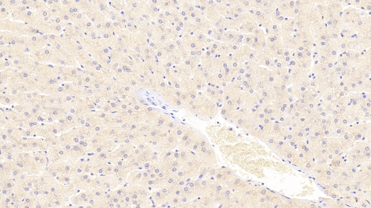 Polyclonal Antibody to Tubulin Alpha 3C (TUBa3C)