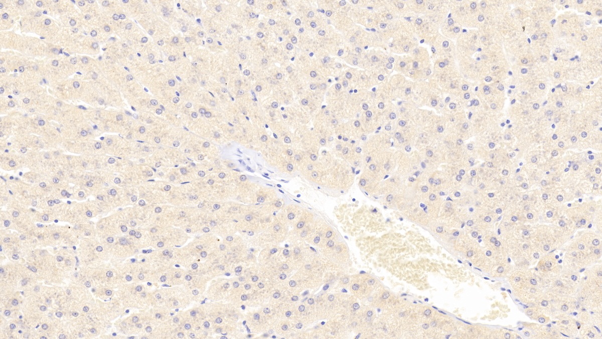 Polyclonal Antibody to Tubulin Alpha 3C (TUBa3C)