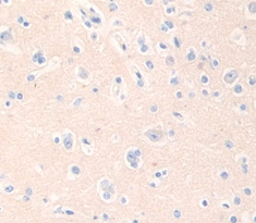 Polyclonal Antibody to Adenomatosis Polyposis Coli Protein (APC)