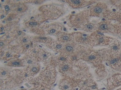 Polyclonal Antibody to Bcl2 Modifying Factor (BMF)