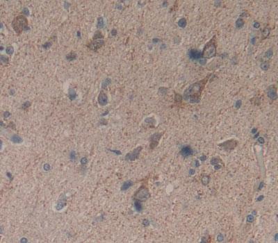 Polyclonal Antibody to Basonuclin 1 (BNC1)