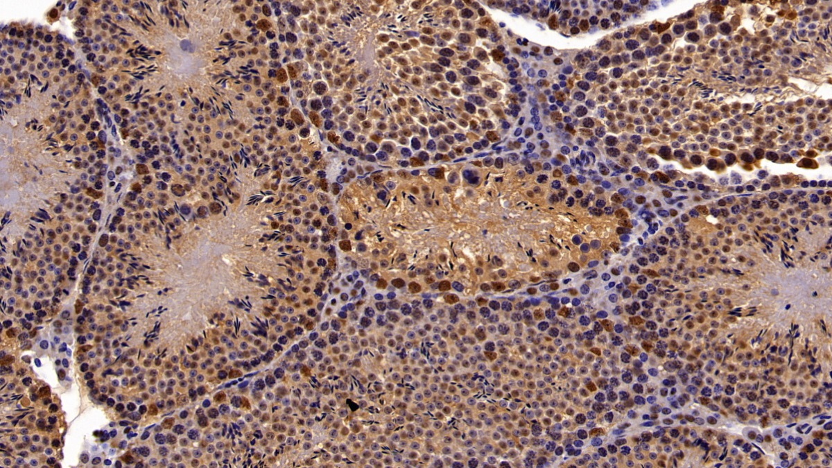 Polyclonal Antibody to Chromobox Homolog 3 (CBX3)