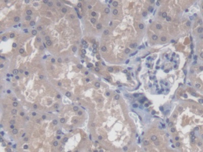 Polyclonal Antibody to Chibby Homolog 1 (CBY1)