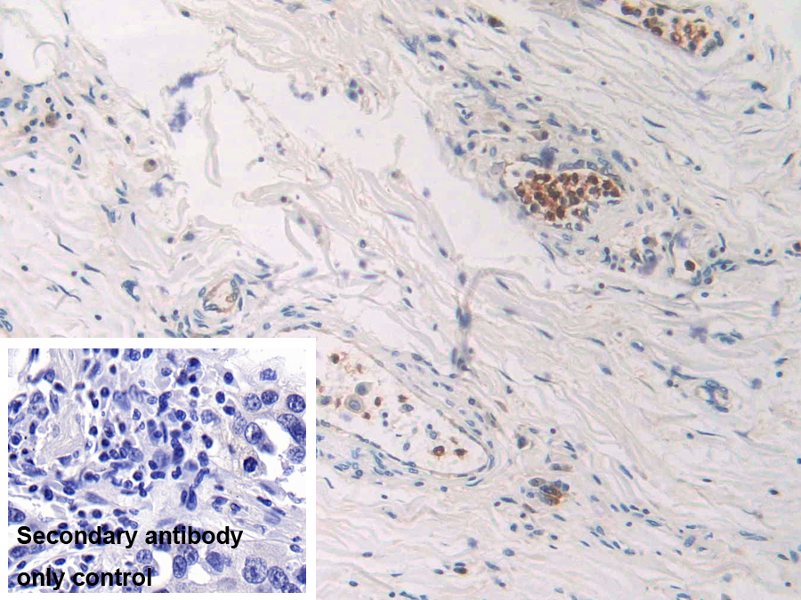 Polyclonal Antibody to Cytidine Deaminase (CDA)