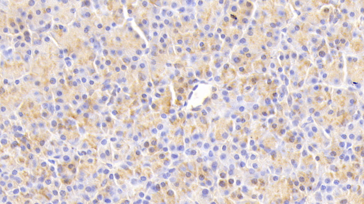 Polyclonal Antibody to Chemokine Like Factor (CKLF)