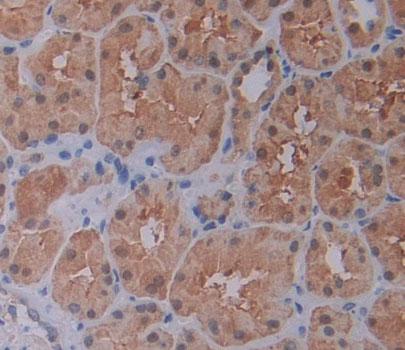 Polyclonal Antibody to C-Terminal Binding Protein 1 (CTBP1)