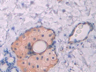 Polyclonal Antibody to Cubilin (CUBN)