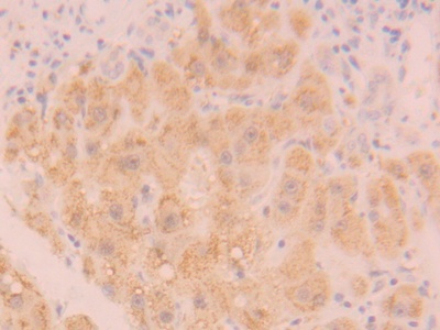 Polyclonal Antibody to Catalase (CAT)