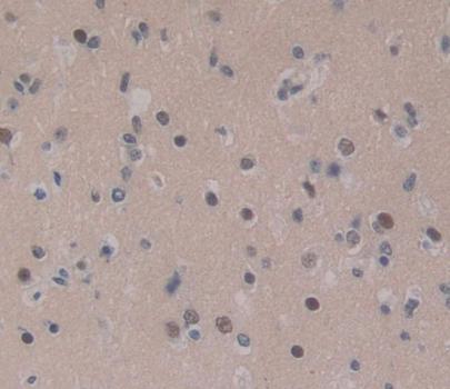 Polyclonal Antibody to CCAAT/Enhancer Binding Protein Delta (CEBPd)