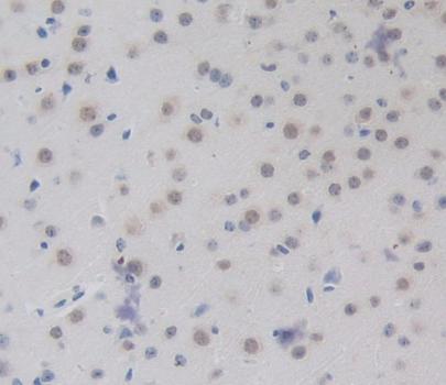 Polyclonal Antibody to CCAAT/Enhancer Binding Protein Delta (CEBPd)