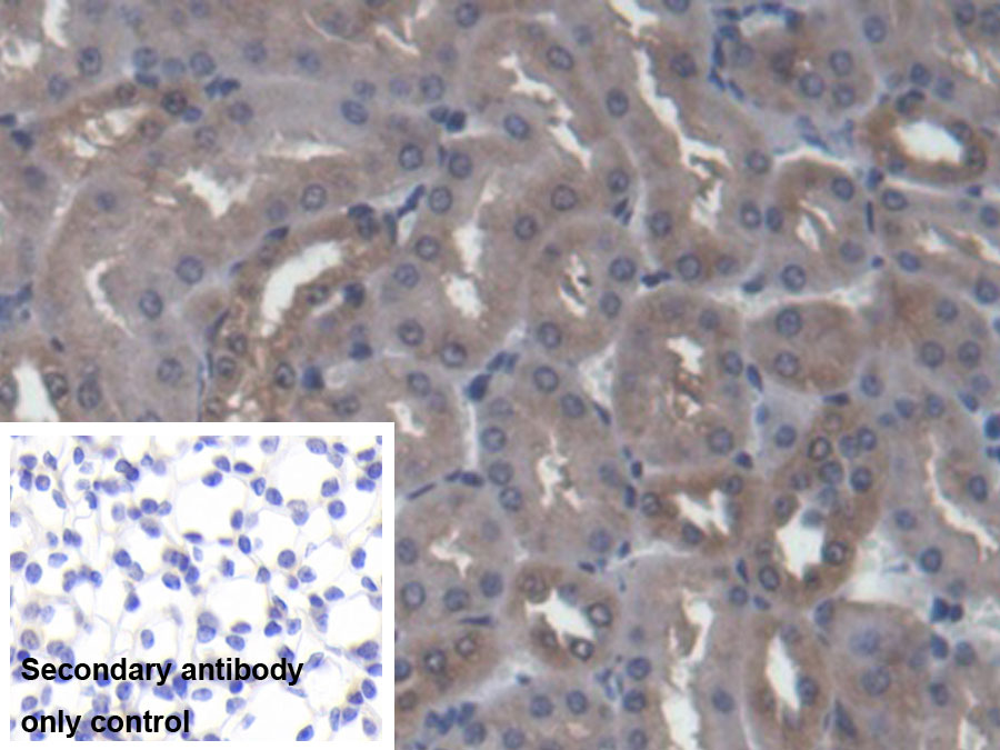 Polyclonal Antibody to Flavin Containing Monooxygenase 2, Non Functional (FMO2)