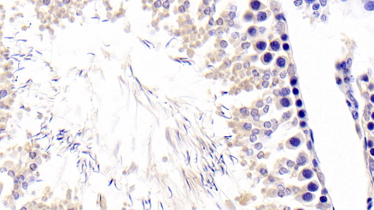 Polyclonal Antibody to Fibrillarin (FBL)