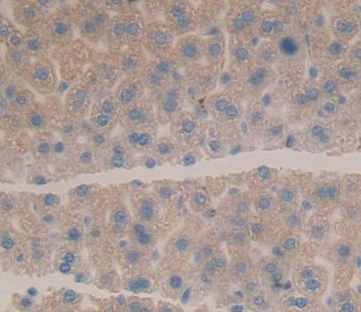 Polyclonal Antibody to Helicase Like Transcription Factor (HLTF)