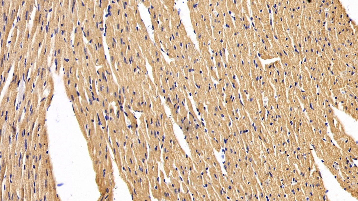 Polyclonal Antibody to Islet Cell Autoantigen 1 (ICA1)