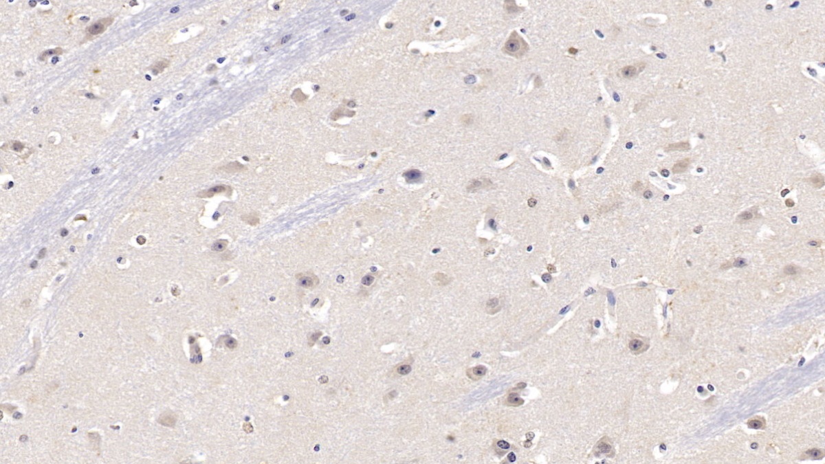 Polyclonal Antibody to Karyopherin Alpha 3 (KPNa3)