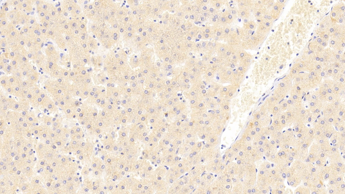 Polyclonal Antibody to Eukaryotic translation initiation factor 2D (EIF2D)