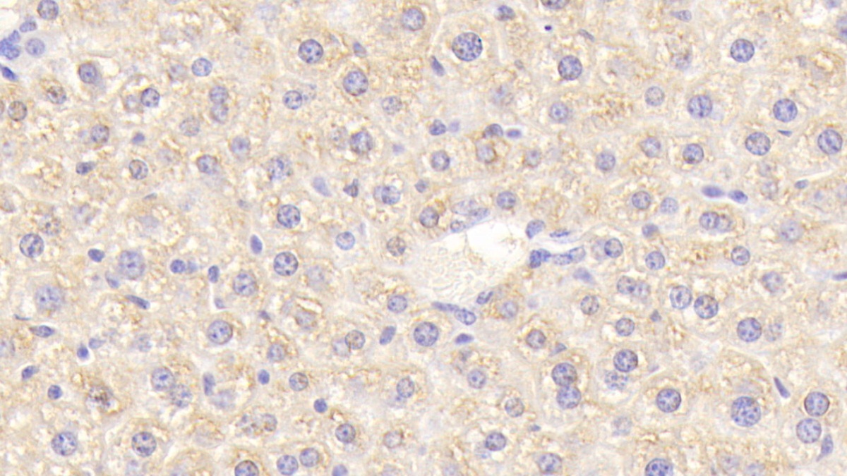 Polyclonal Antibody to Eukaryotic translation initiation factor 2D (EIF2D)