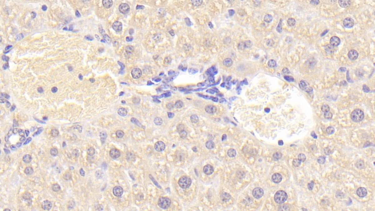 Polyclonal Antibody to Lysophospholipase I (LYPLA1)
