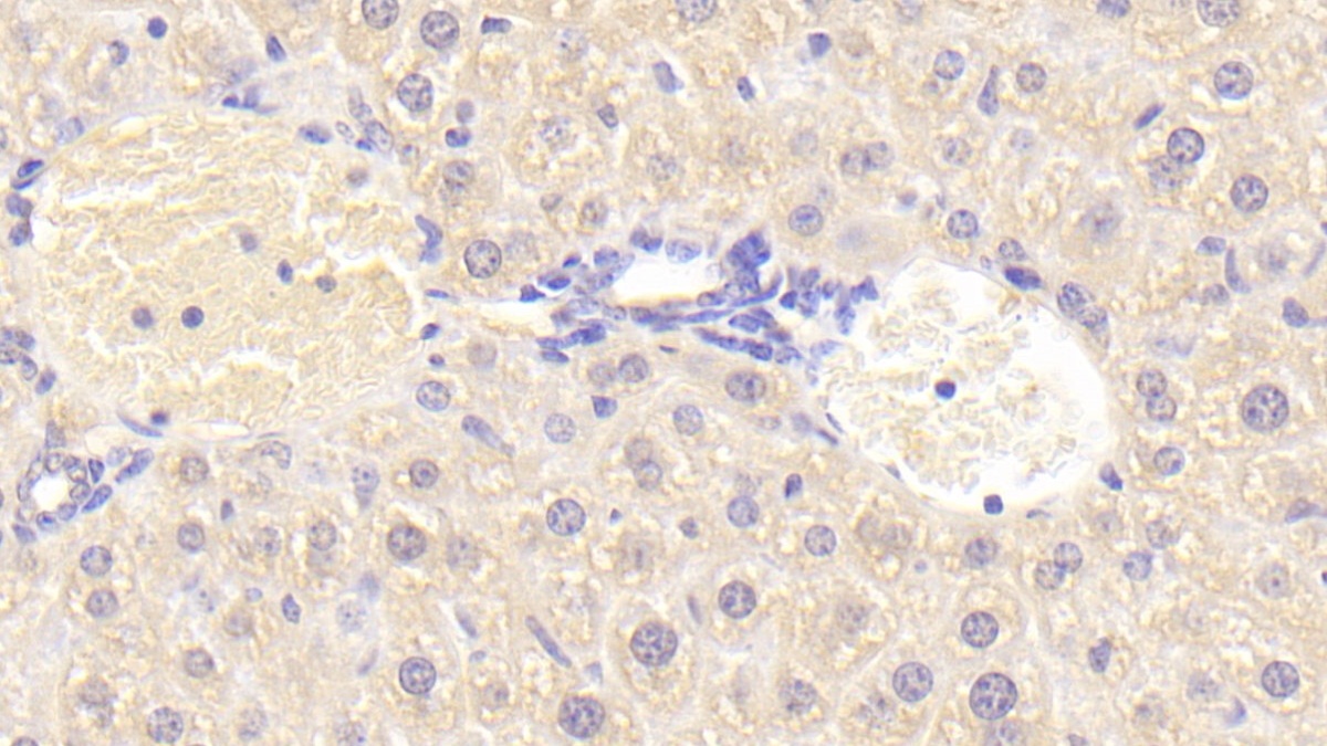 Polyclonal Antibody to Lysophospholipase I (LYPLA1)