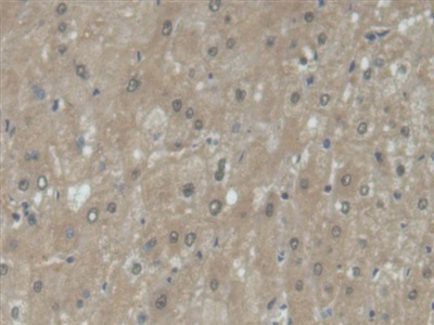 Polyclonal Antibody to Beta-ureidopropionase (UPB1)