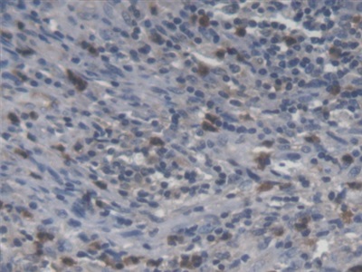 Polyclonal Antibody to Ubiquitously Expressed Transcript (UXT)