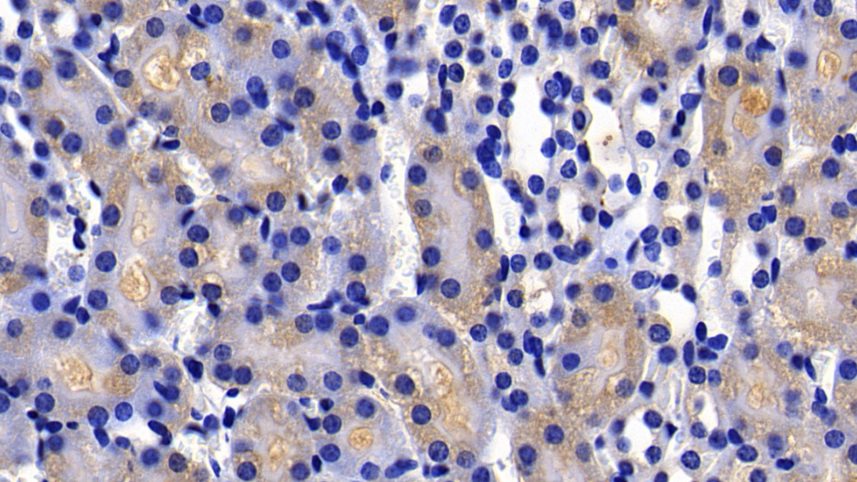 Polyclonal Antibody to X-linked Inhibitor Of Apoptosis Protein (XIAP)