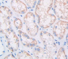 Polyclonal Antibody to Multimerin 1 (MMRN1)
