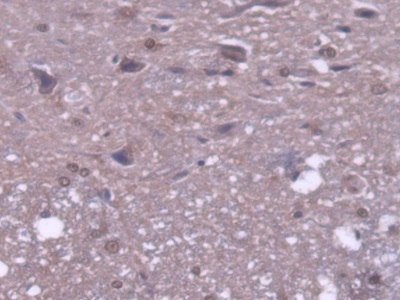 Polyclonal Antibody to Mitochondrial Tumor Suppressor 1 (MTUS1)