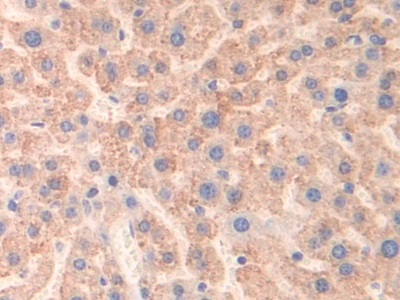 Polyclonal Antibody to Monoamine Oxidase B (MAOB)