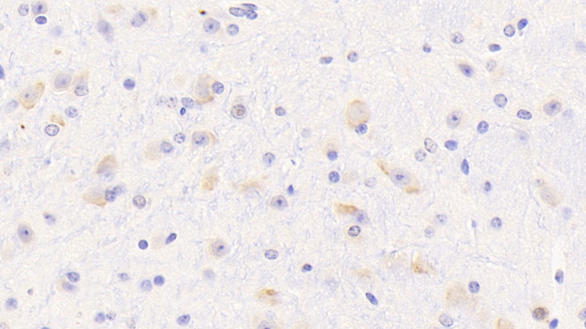 Polyclonal Antibody to Oligophrenin 1 (OPHN1)