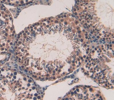 Polyclonal Antibody to Pituitary Tumor Transforming 1 (PTTG1)