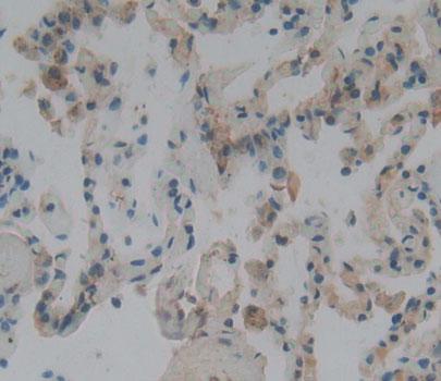 Polyclonal Antibody to Plectin (PLEC)