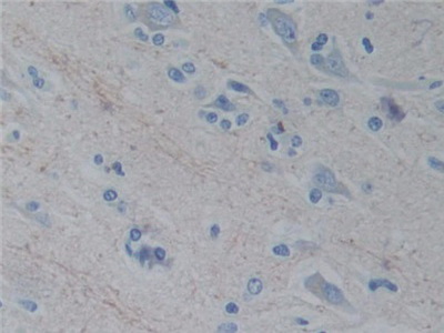 Polyclonal Antibody to Reelin (RELN)