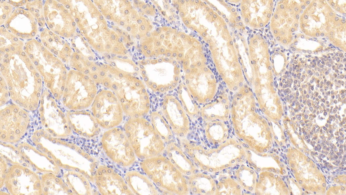 Polyclonal Antibody to Transmembrane Protease, Serine 2 (TMPRSS2)