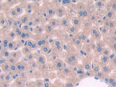 Polyclonal Antibody to Tripeptidyl Peptidase I (TPP1)
