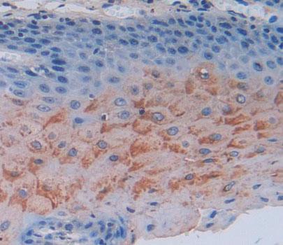 Polyclonal Antibody to Sciellin (SCEL)